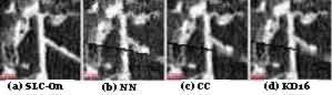 Panchromatic SLC-On (a) and SLC-Off (b, c and d) bands show the effect of interpolation on a linear feature with various resampling methods. Select for detailed view. 36Kb