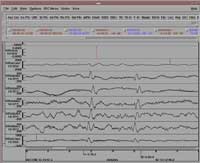 Infrasonic recording of a meteorite at the IS07 (courtesy of CMR Infrasound Waveform Library)