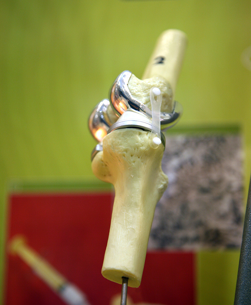 Shiny, silver coloured, metal replica knee joint between two white coloured plastic replica bones