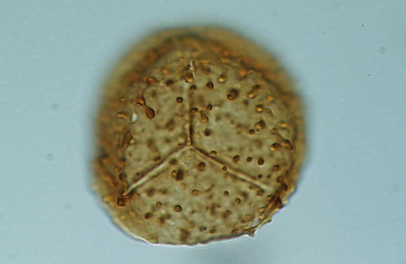 Photomicrograph of a round pollen spore (type and source not specified)
