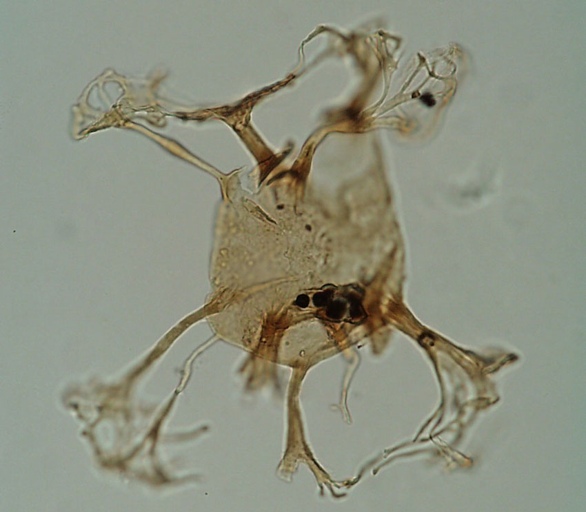 Photomicrograph of a dinoflagellate with highly irregular shape comprising a central ‘body’ and seven ‘arms’ radiating out in different directions (type and source not specified)