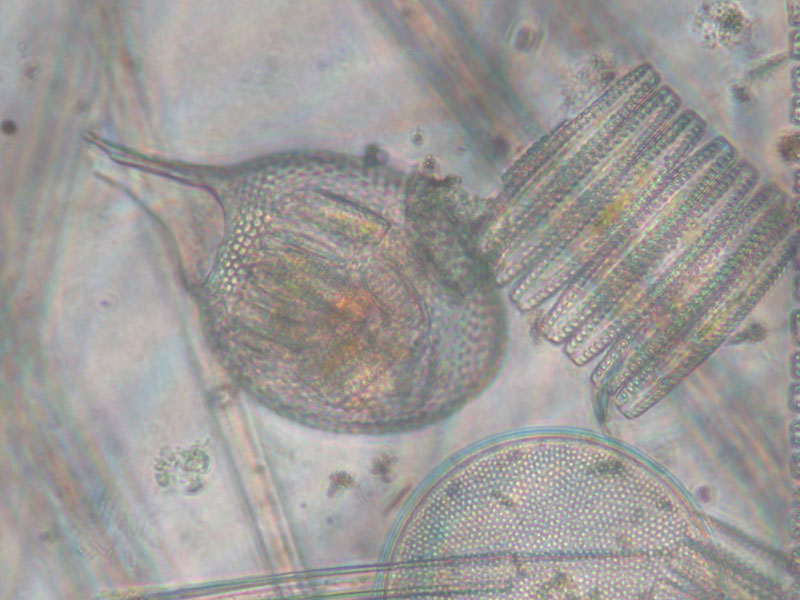 Photomicrograph of radiolarian and multiple diatoms from sub-Antarctic waters of the Southern Ocean. The radiolarian is oval in shape with numerous small holes through its shell. The diatoms are perfectly symmetrical in shape and include a circular type with small holes across its surface and a chain of seven oblong diatoms (called pennates) (type and source not specified)