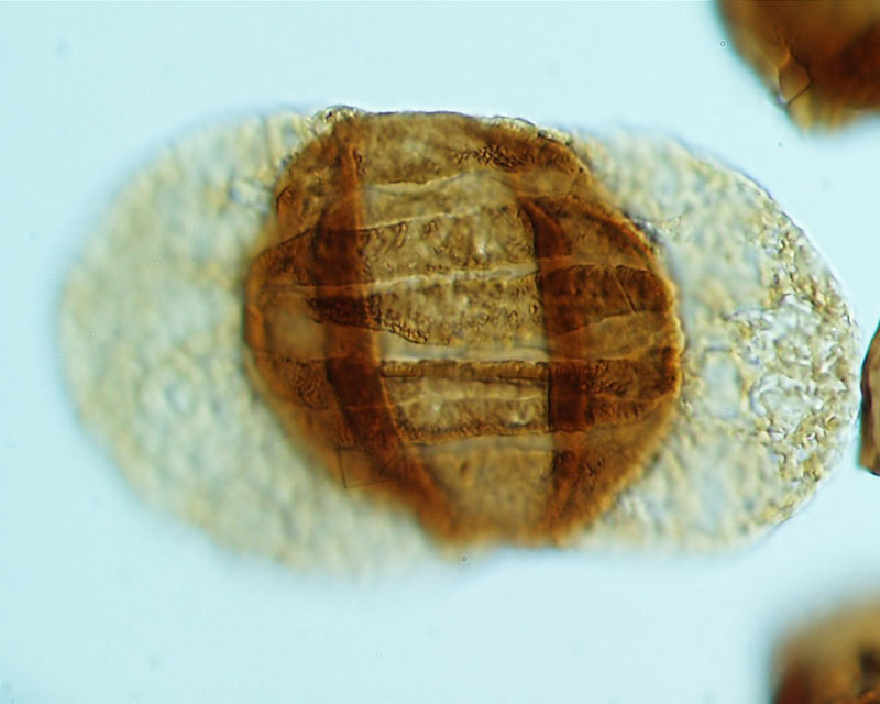 Photomicrograph of a pollen spore with irregular semi-circular shape (type and source not specified)